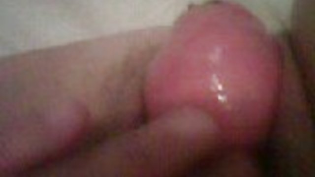 ورزش ها باعث پاره شدن اشک به مرد طاس می شود